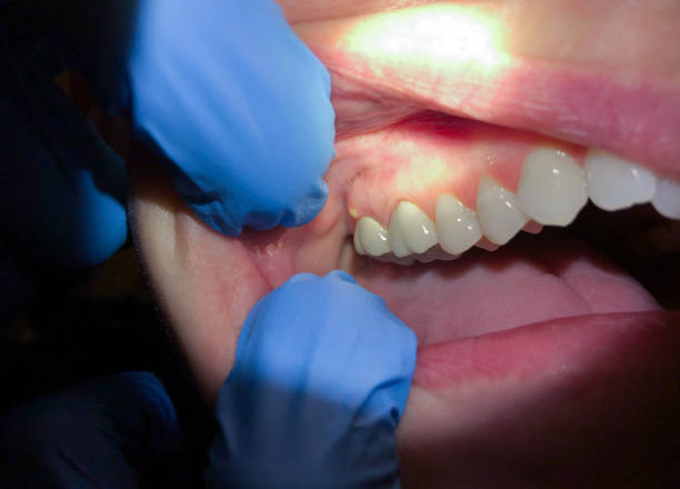Best Emergency Dentist Open Today  in Chauvin, LA